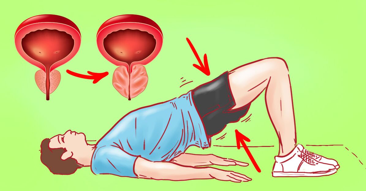 gimnastične vaje za prostatitis